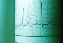 call frequency analysis tool